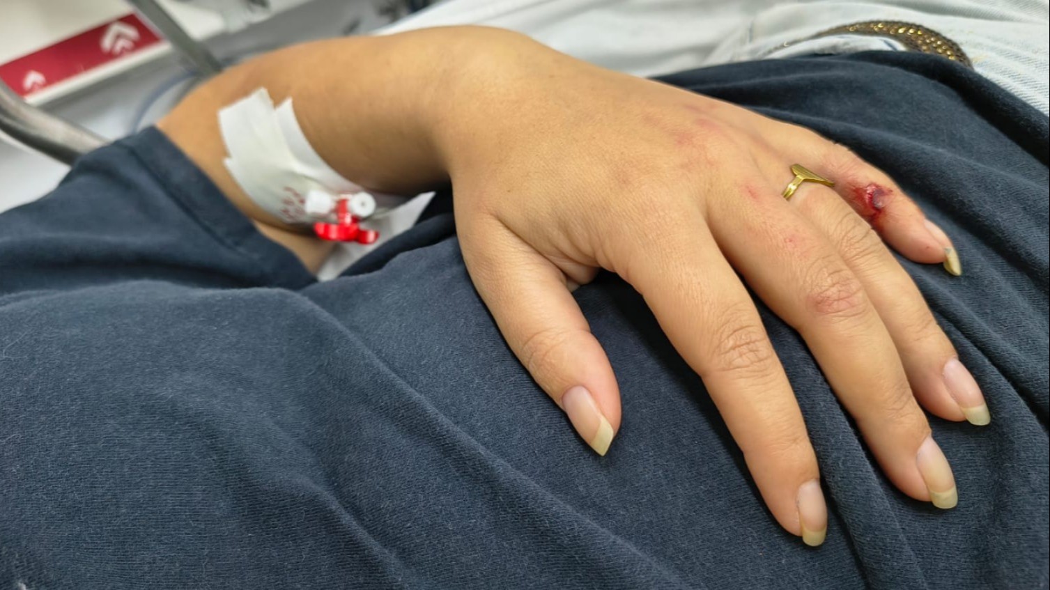 Homem é preso após esfaquear e agredir esposa em Rio Preto